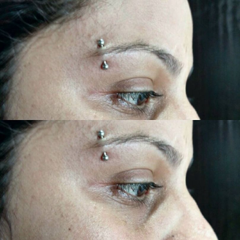 PIERCING NA SOBRANCELHA INFLAMOU, COMO CUIDAR ? 